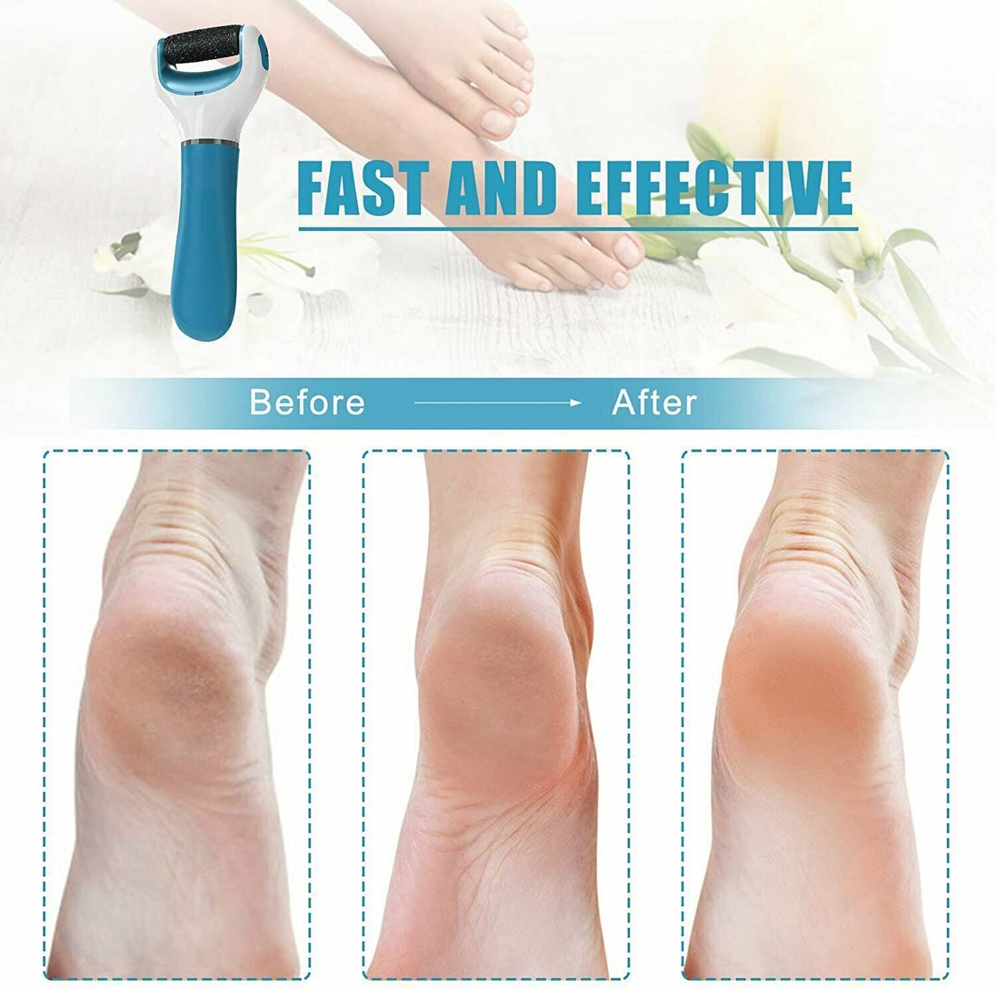Electric Dry Foot File Callus Remover – Coarse & Regular Roller for At-Home Pedicure, Battery-Powered Foot Care Tool (USB Rechargeable, Battery Not Included)